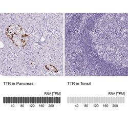 Transthyretin/Prealbumin Antibody (CL0290) - Azide and BSA Free, Novus