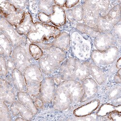 TRPM4 Antibody (CL11214) - Azide and BSA Free, Novus Biologicals 100 ul;
