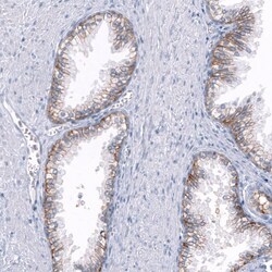 TRPM4 Antibody (CL11214) - Azide and BSA Free, Novus Biologicals 100 ul;