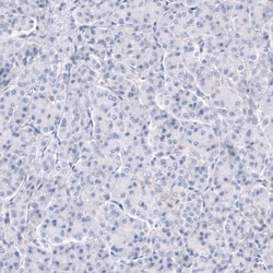 TRPM4 Antibody (CL11214) - Azide and BSA Free, Novus Biologicals 100 ul;