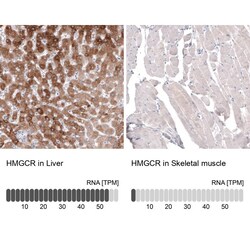 HMG-CoA Reductase/HMGCR Antibody (CL0259) - Azide and BSA Free, Novus Biologicals