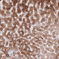 HMG-CoA Reductase/HMGCR Antibody (CL0259) - Azide and BSA Free, Novus Biologicals