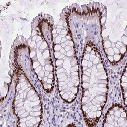 SATB2 Antibody (CL0319) - Azide and BSA Free, Novus Biologicals 100 ul;