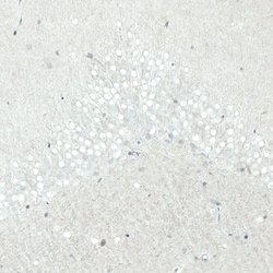 SATB2 Antibody (CL0319) - Azide and BSA Free, Novus Biologicals 100 ul;