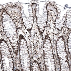PI 3-Kinase p110 beta/PIK3CB Antibody (CL9518) - Azide and BSA Free, Novus Biologicals 100 &mu;L | Buy Online | Novus Biologicals | Fisher Scientific
