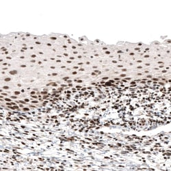 PI 3-Kinase p110 beta/PIK3CB Antibody (CL9518) - Azide and BSA Free, Novus Biologicals 100 &mu;L | Buy Online | Novus Biologicals | Fisher Scientific