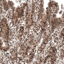 PI 3-Kinase p110 beta/PIK3CB Antibody (CL9518) - Azide and BSA Free, Novus Biologicals 100 &mu;L | Buy Online | Novus Biologicals | Fisher Scientific