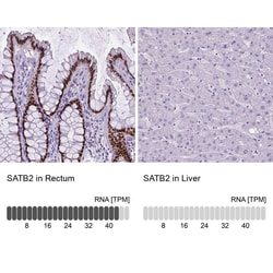 SATB2 Antibody (CL0321) - Azide and BSA Free, Novus Biologicals 100 ul;