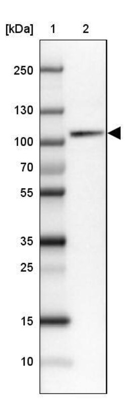 SATB2 Antibody (CL0321) - Azide and BSA Free, Novus Biologicals 100 ul;