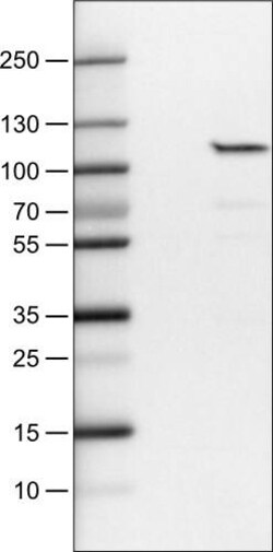 SATB2 Antibody (CL0321) - Azide and BSA Free, Novus Biologicals 100 ul;