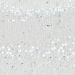 SATB2 Antibody (CL0321) - Azide and BSA Free, Novus Biologicals 100 ul;