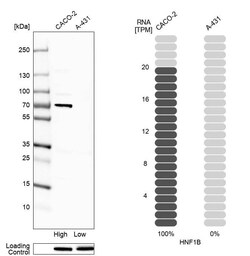 TCF-2/HNF-1 beta Antibody (CL0374) - Azide and BSA Free, Novus Biologicals