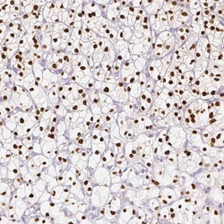 TCF-2/HNF-1 beta Antibody (CL0374) - Azide and BSA Free, Novus Biologicals