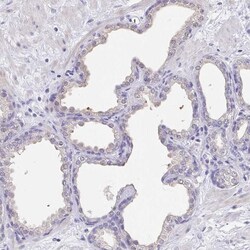 RNASE7 Antibody (CL0224) - Azide and BSA Free, Novus Biologicals 100 ul;