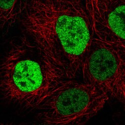 p53 Antibody (CL2199) - Azide and BSA Free, Novus Biologicals 100 ul; Unconjugated:Antibodies,