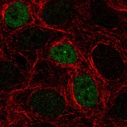 p53 Antibody (CL2199) - Azide and BSA Free, Novus Biologicals 100 ul; Unconjugated:Antibodies,