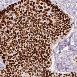 p53 Antibody (CL2199) - Azide and BSA Free, Novus Biologicals 100 ul; Unconjugated:Antibodies,