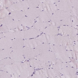 p53 Antibody (CL2199) - Azide and BSA Free, Novus Biologicals 100 ul; Unconjugated:Antibodies,