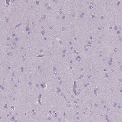 CD40/TNFRSF5 Antibody (CL1673) - Azide and BSA Free, Novus Biologicals