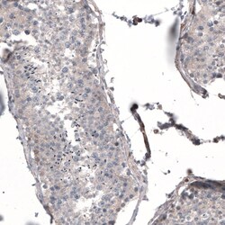Profilin 1 Antibody (CL3524) - Azide and BSA Free, Novus Biologicals 100