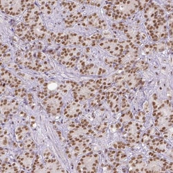 ERCC1 Antibody (CL1249) - Azide and BSA Free, Novus Biologicals 100 ul;
