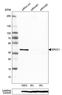 ERCC1 Antibody (CL1284) - Azide and BSA Free, Novus Biologicals 100 ul;
