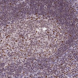 ERCC1 Antibody (CL1284) - Azide and BSA Free, Novus Biologicals 100 ul;