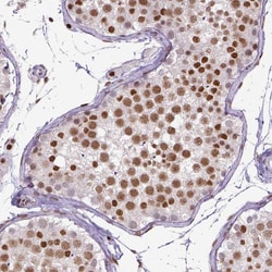 ERCC1 Antibody (CL1284) - Azide and BSA Free, Novus Biologicals 100 ul;