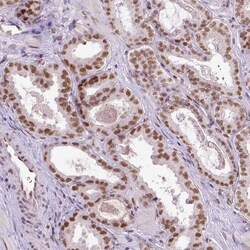ERCC1 Antibody (CL1284) - Azide and BSA Free, Novus Biologicals 100 ul;