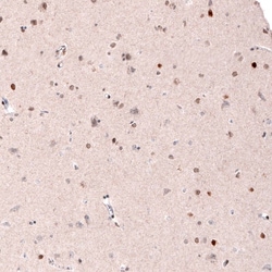 CDP/CUTL1 Antibody (CL5278) - Azide and BSA Free, Novus Biologicals 100