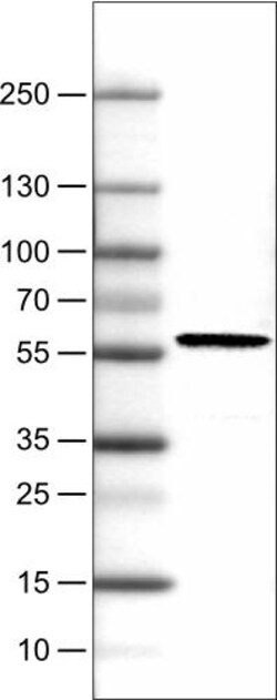 PHGDH Antibody (CL0555) - Azide and BSA Free, Novus Biologicals 100 ul;