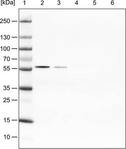 PHGDH Antibody (CL0555) - Azide and BSA Free, Novus Biologicals 100 ul;