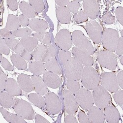 PHGDH Antibody (CL0555) - Azide and BSA Free, Novus Biologicals 100 ul;