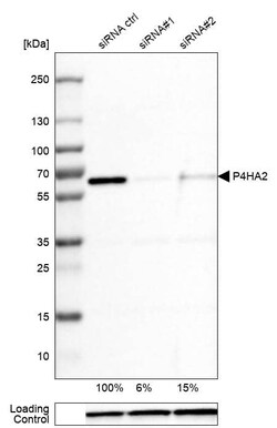 P4HA2 Antibody (CL0351) - Azide and BSA Free, Novus Biologicals 100 ul;