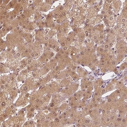 NAPRT1 Antibody (CL0366) - Azide and BSA Free, Novus Biologicals 100 ul;