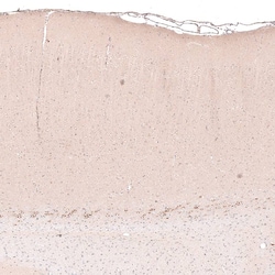 CTGF/CCN2 Antibody (CL5339) - Azide and BSA Free, Novus Biologicals 100