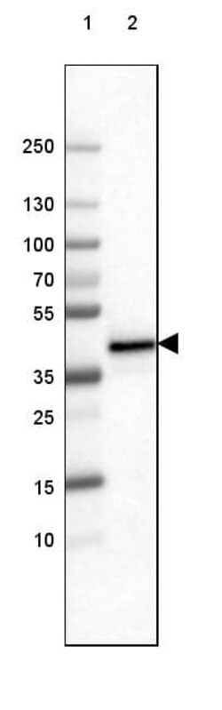 FCRN/FCGRT Antibody (CL3640) - Azide and BSA Free, Novus Biologicals 100