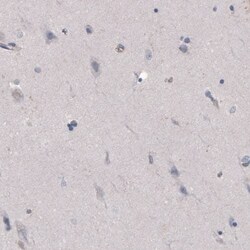 FCRN/FCGRT Antibody (CL3640) - Azide and BSA Free, Novus Biologicals 100
