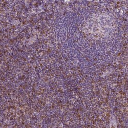 S100A4 Antibody (CL0237) - Azide and BSA Free, Novus Biologicals 100 ul;