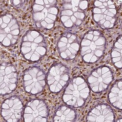 S100A4 Antibody (CL0239) - Azide and BSA Free, Novus Biologicals 100 ul;