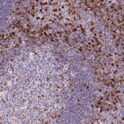 S100A4 Antibody (CL0240) - Azide and BSA Free, Novus Biologicals 100 ul;