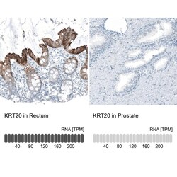 Cytokeratin 20 Antibody (CL9390) - Azide and BSA Free, Novus Biologicals