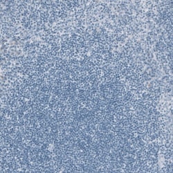 Cytokeratin 20 Antibody (CL9390) - Azide and BSA Free, Novus Biologicals