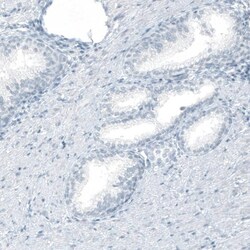 Cytokeratin 20 Antibody (CL9390) - Azide and BSA Free, Novus Biologicals