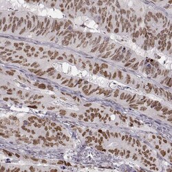 Snail Antibody (CL3700) - Azide and BSA Free, Novus Biologicals 100 ul;