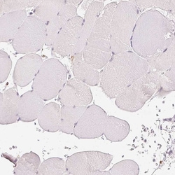 MMR/CD206/Mannose Receptor Antibody (CL0387) - Azide and BSA Free, Novus