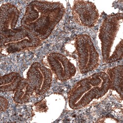 LAMP-1/CD107a Antibody (CL3484) - Azide and BSA Free, Novus Biologicals