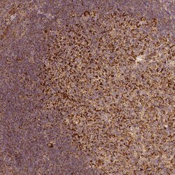 PGAM5 Antibody (CL0624) - Azide and BSA Free, Novus Biologicals 100 ul;
