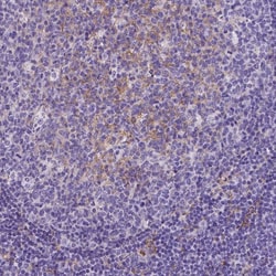 CD14 Antibody (CL1638) - Azide and BSA Free, Novus Biologicals 100 ul;