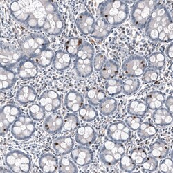 INSM1 Antibody (CL11630) - Azide and BSA Free, Novus Biologicals 100 ul;